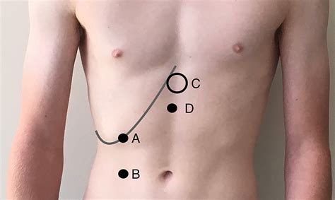 scratch test for liver|can you palpate the liver.